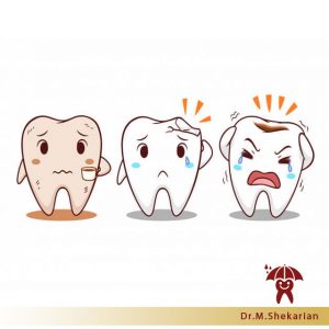 پوسیدگی دندان در کودکان؛ از علائم تا مهمترین علت های آن