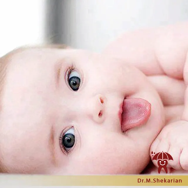 برفک دهان نوزادان
