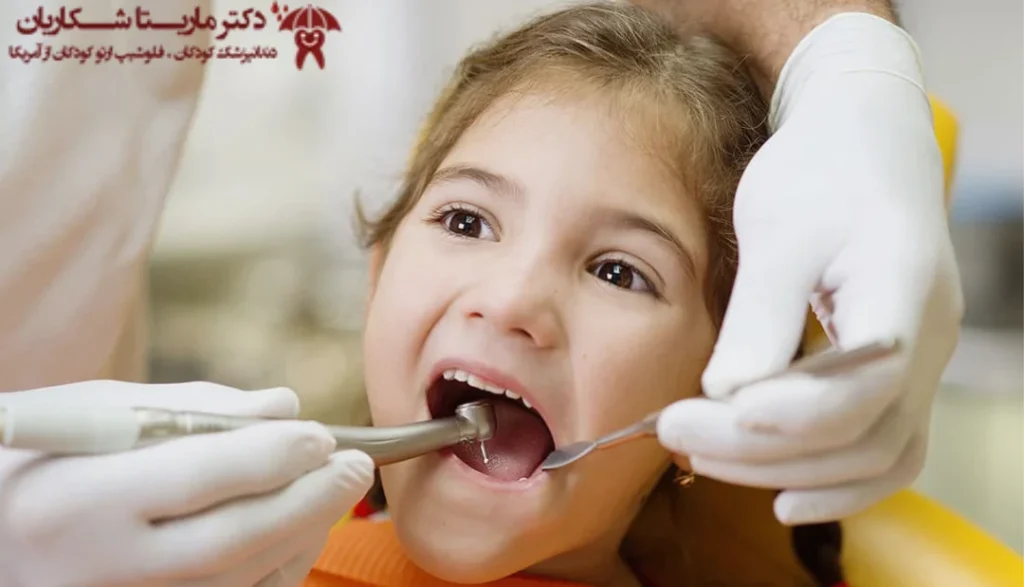 معاینه دندان های شیری توسط دندانپزشک
