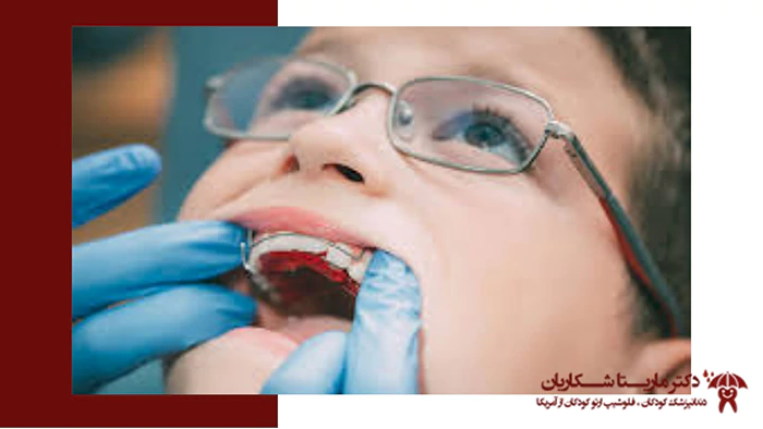 ارتودنسی پیشگیری چیست؟