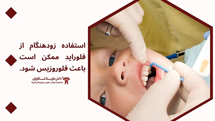 سن فلورایدتراپی