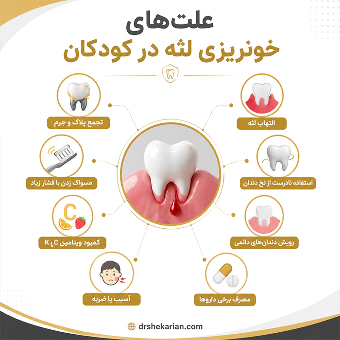 علت خونریزی لثه کودک